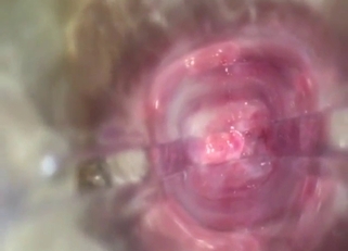 Speculum passion with a loose animal vag